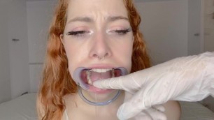 Dentists Mouth Exploration - Teaser